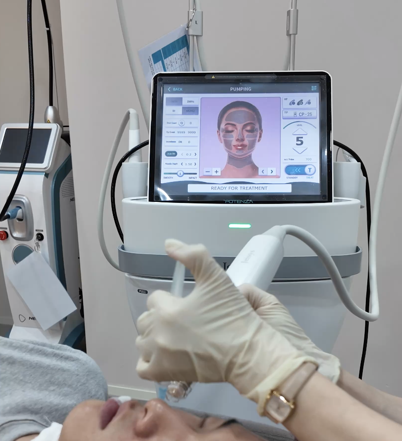 Potenza RF microneedling treatment at LIJIN Seoul skin clinic in Myeongdong